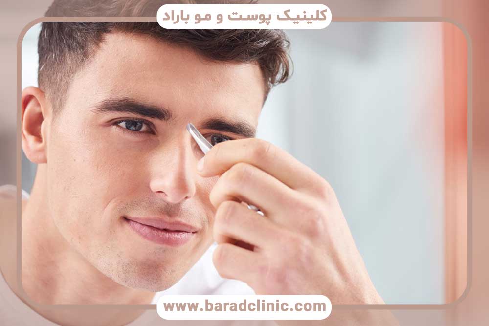 قیمت کاشت ابرو طبیعی مردانه تهران