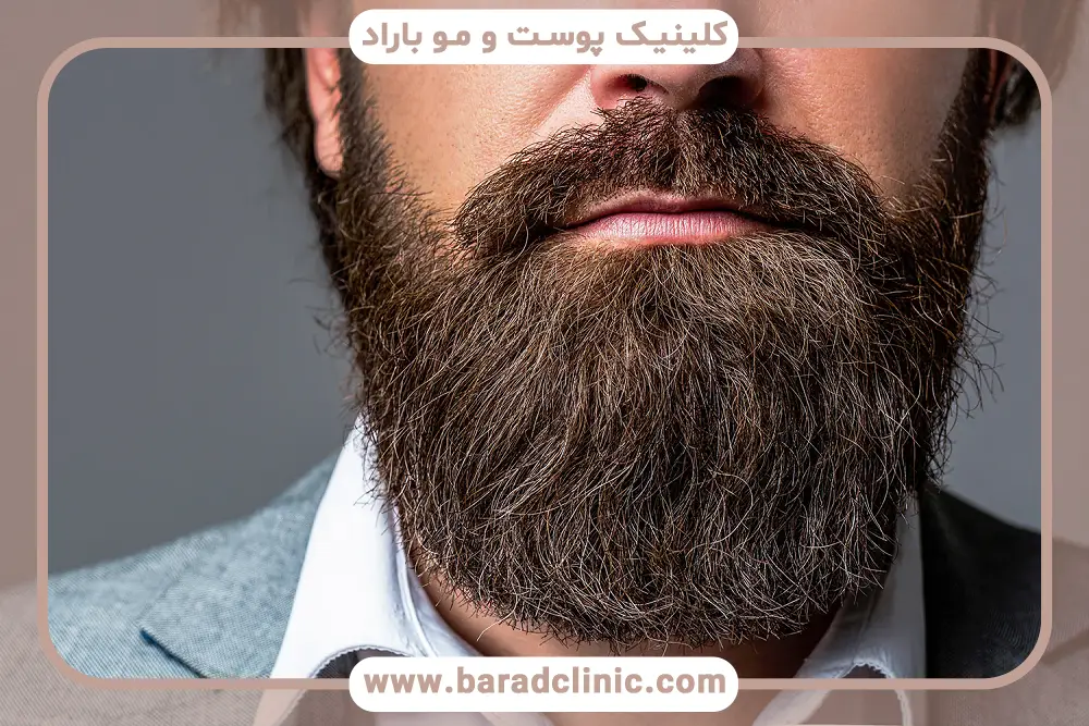 تفاوت هزینه کاشت سبیل با ریش