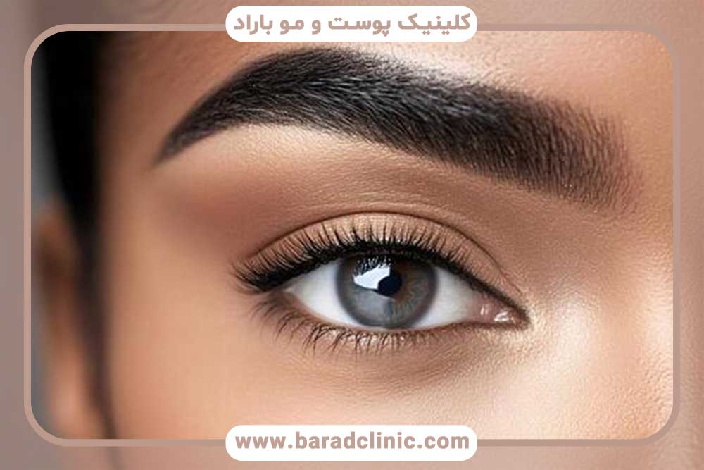 کاشت ابرو دخترانه برای صورت گرد