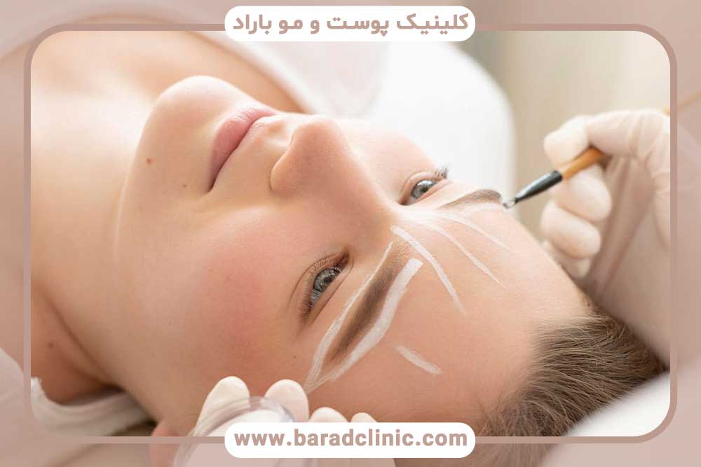 کاشت ابرو دخترانه قسطی