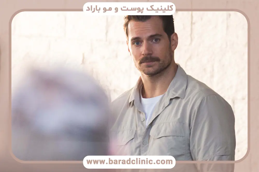 عوارض رایج در دوره نقاهت کاشت سبیل