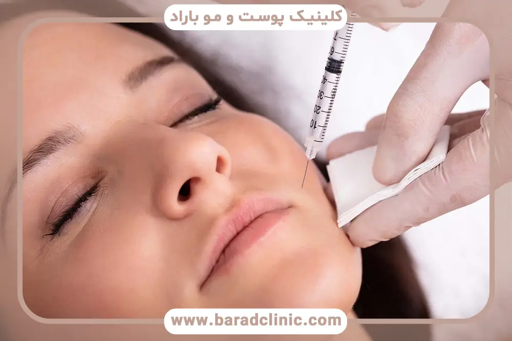 علائم بهترین سن بوتاکس