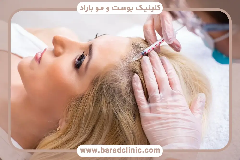 تفاوت هزینه PRP مو