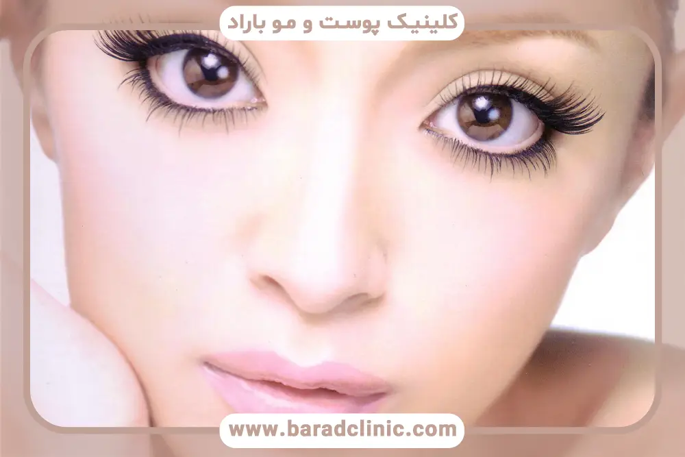 متوسط هزینه عمل بلفاروپلاستی در کلینیک باراد