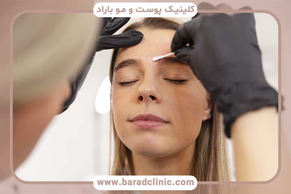 کاشت ابرو اقساطی بهترین کلینیک تهران
