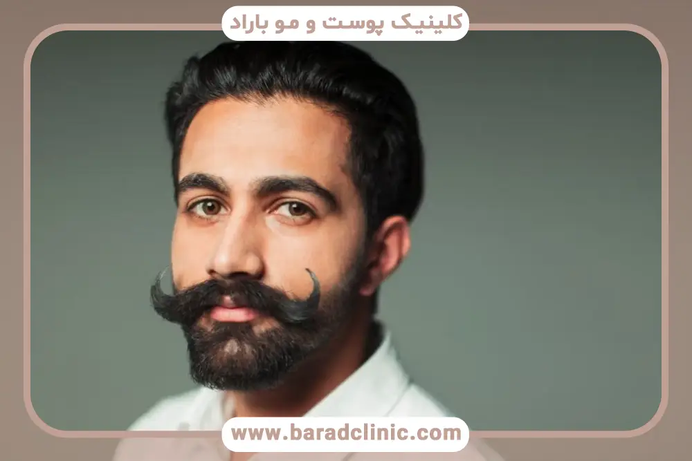 انتخاب کلینیک با کمترین هزینه کاشت سبیل در تهران