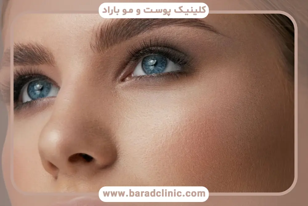 تفاوت هزینه جراحی بلفاروپلاستی فوقانی تهران