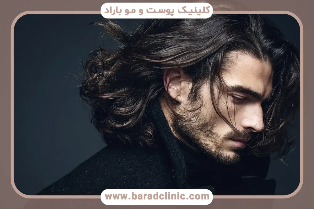 درد و دوره نقاهت از معایب کاشت مو