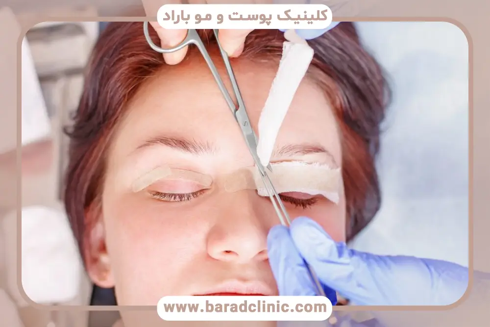 معیارهای بهترین کلینیک بلفاروپلاستی با لیزر