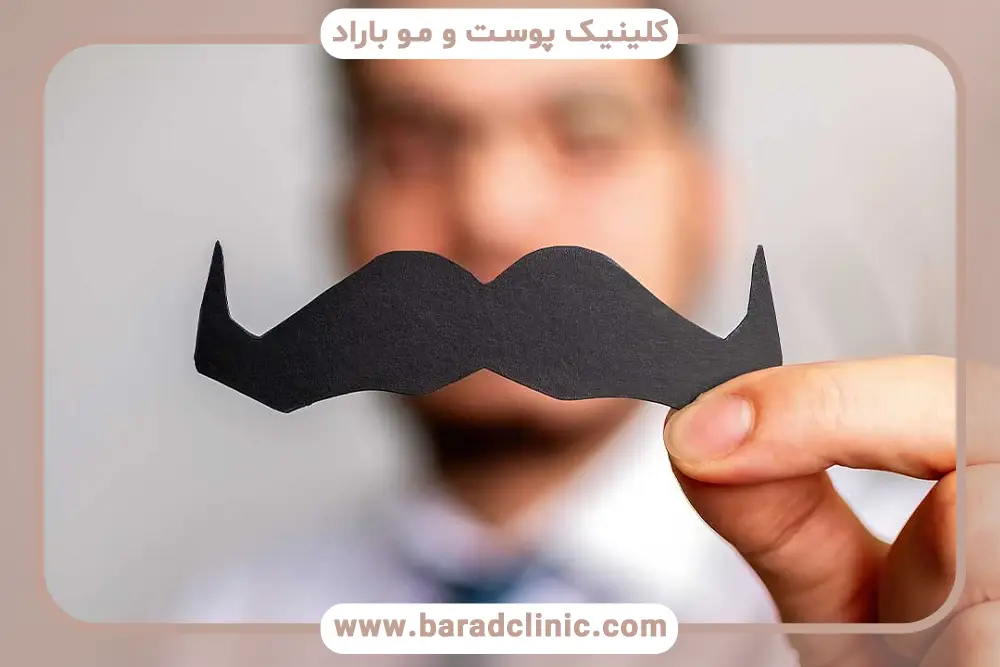 مراحل مزوتراپی سبیل