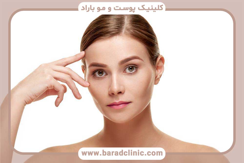 کاشت ابرو دخترانه برای صورت کشیده تهران