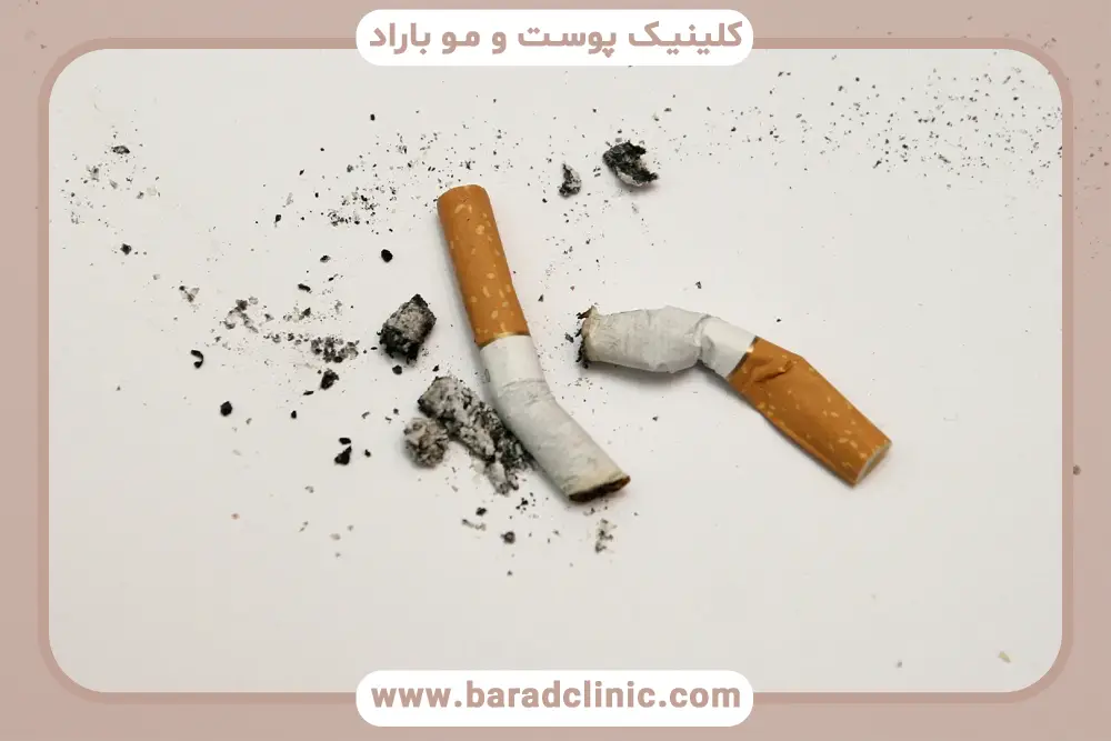 بررسی عملکرد سیگار و مشروب بعد از کاشت مو