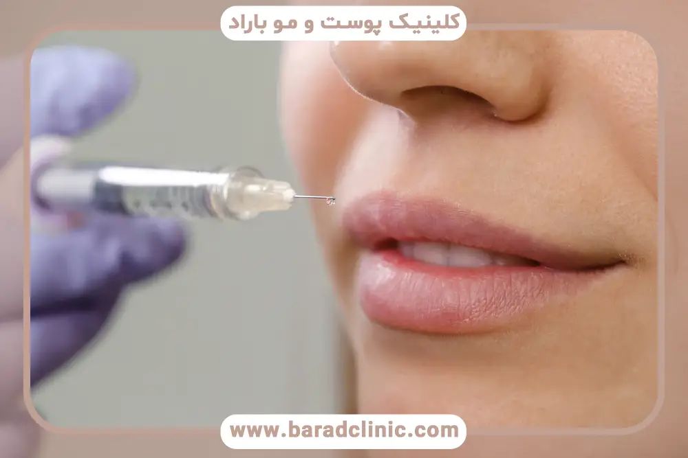 عوارض بوتاکس لب