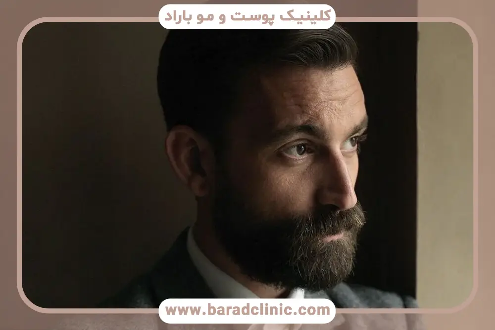 هزینه‌های جانبی کاشت سبیل