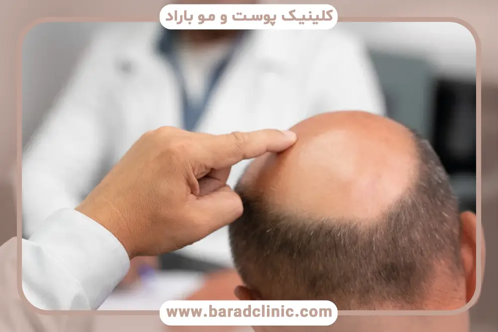 عوارض جانبی بلفاروپلاستی بدون جراحی تهران