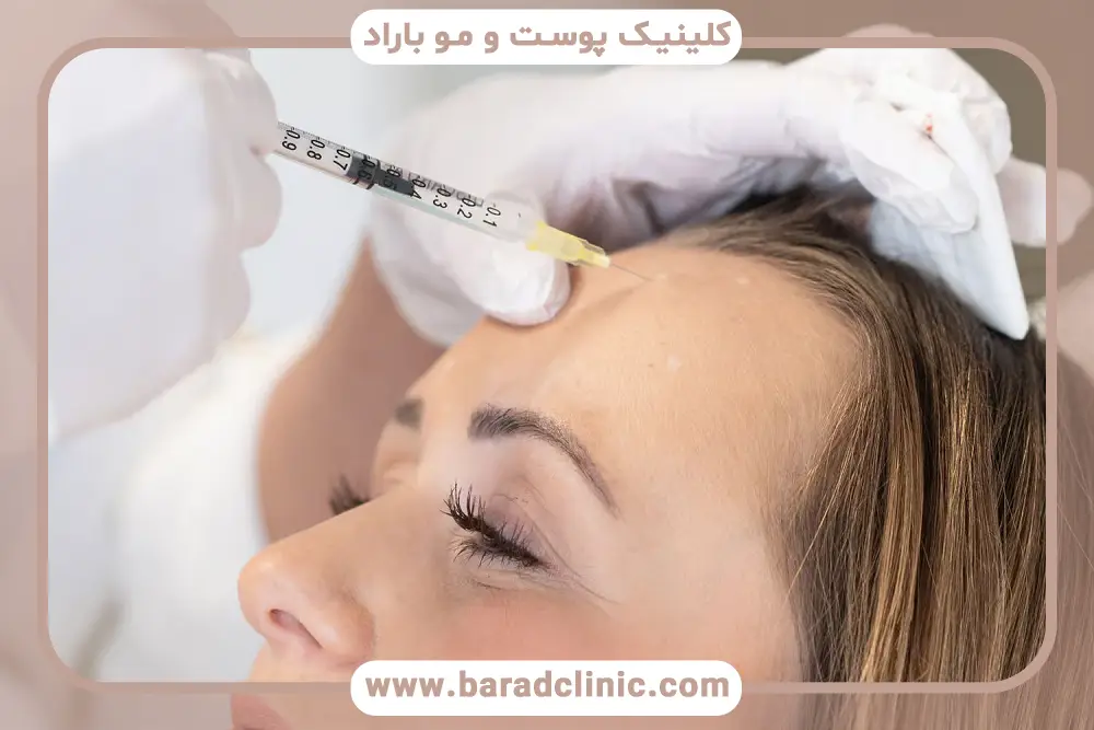 عوامل موثر بر بهترین سن بوتاکس