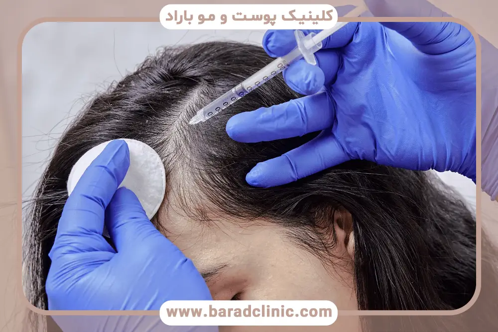 تاثیر برند روی هزینه PRP مو