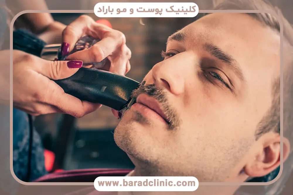 عوارض احتمالی کاشت سبیل