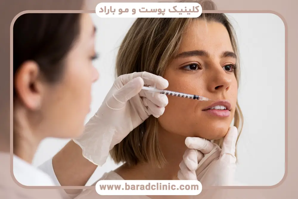نتایج نهایی بوتاکس خط خنده