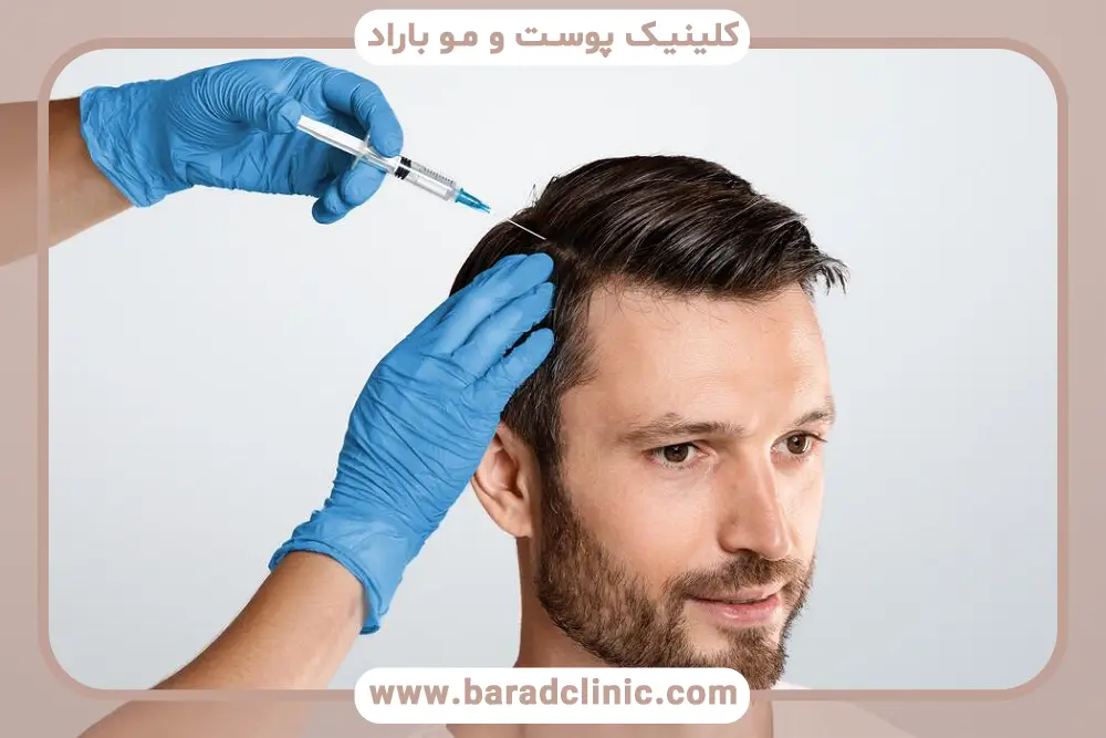 کاندیدای مناسب مزوتراپی سر