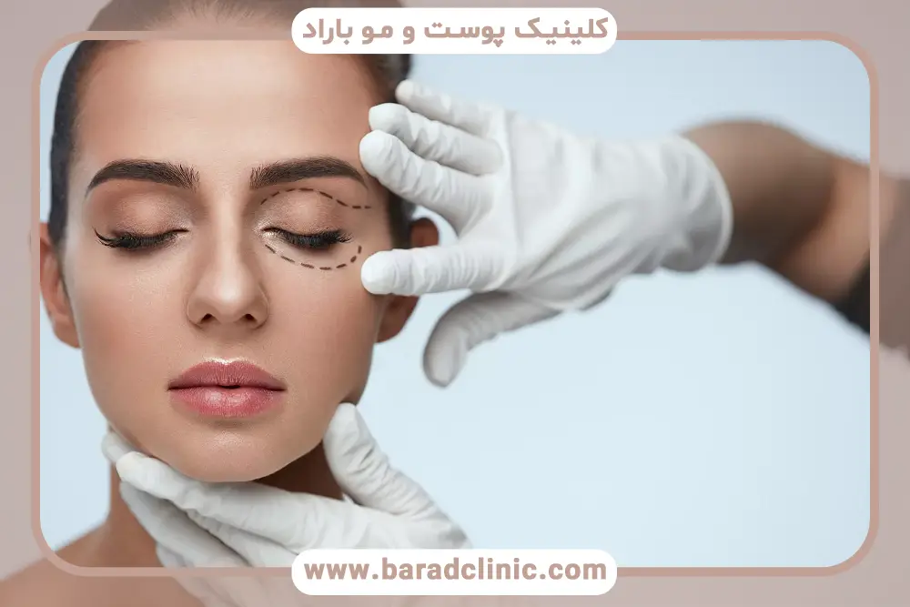 تکنولوژی‌های بهترین کلینیک بلفاروپلاستی با لیزر