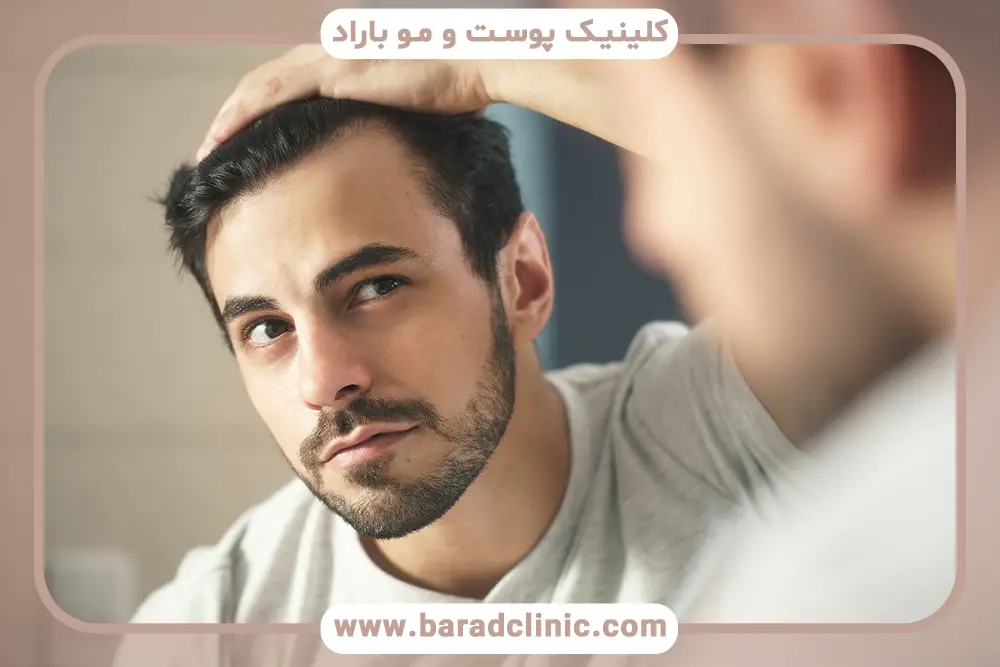 مراحل کاشت مو جلو پیشانی