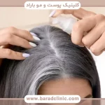 نقش ملانین در رنگ مو و سفید شدن مو