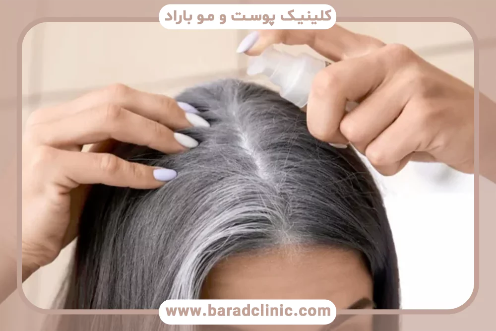 نقش ملانین در رنگ مو و سفید شدن مو