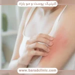 پوست حساس؛ چرا بعضی افراد ذاتاً واکنش‌پذیرترند؟