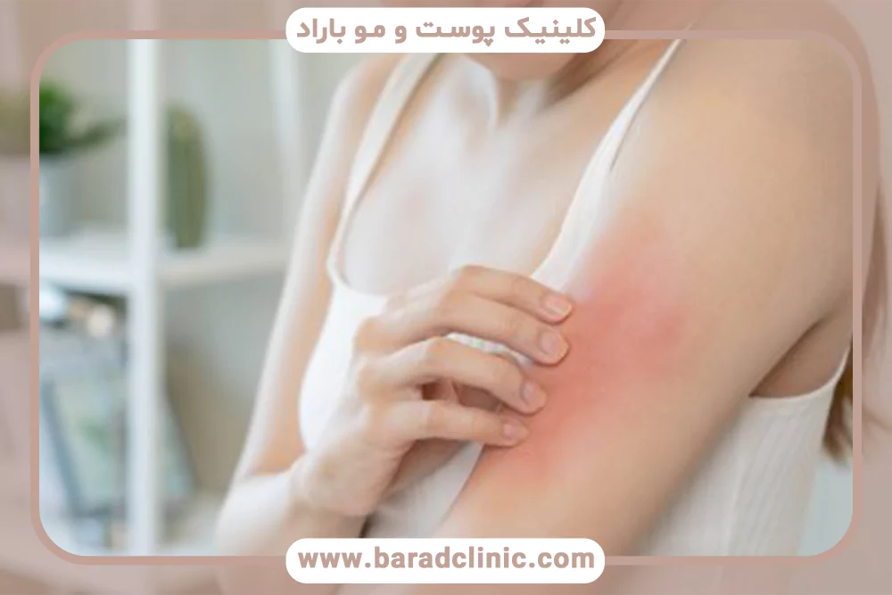 پوست حساس؛ چرا بعضی افراد ذاتاً واکنش‌پذیرترند؟