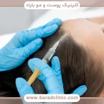 درمان های غیرجراحی ریزش مو چیست؟