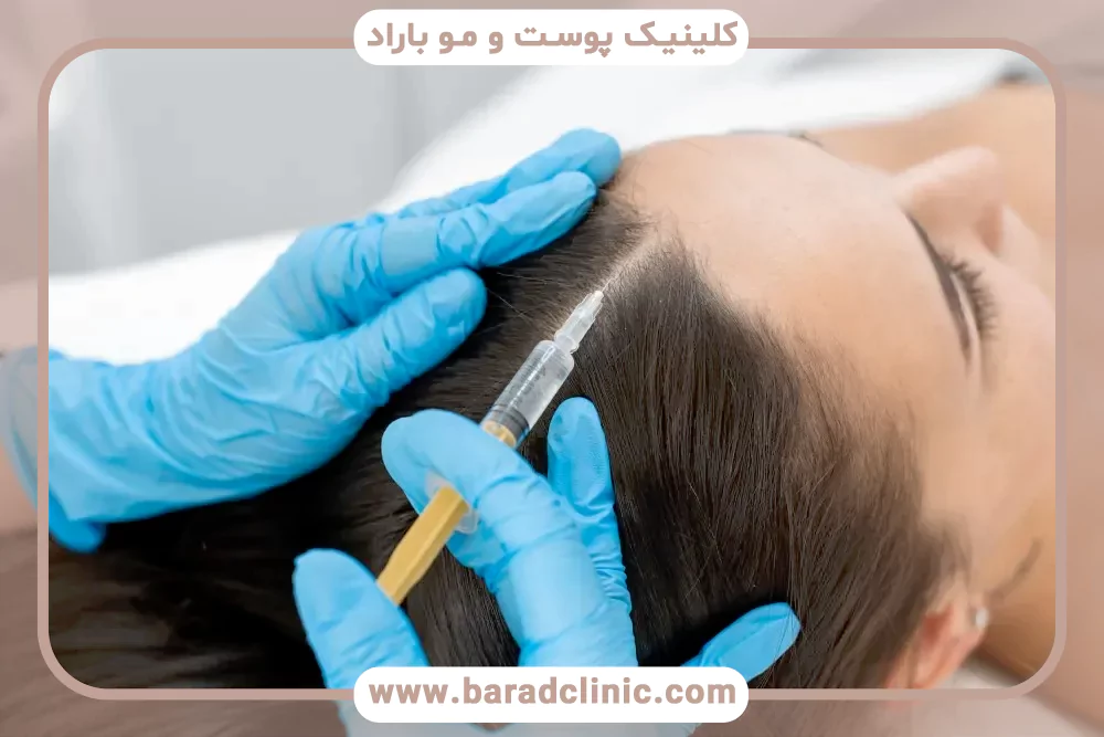 درمان های غیرجراحی ریزش مو چیست؟