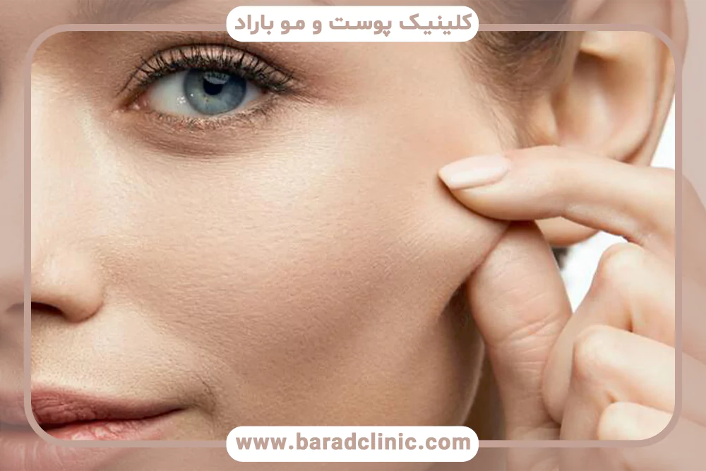 الاستین و کشسانی پوست