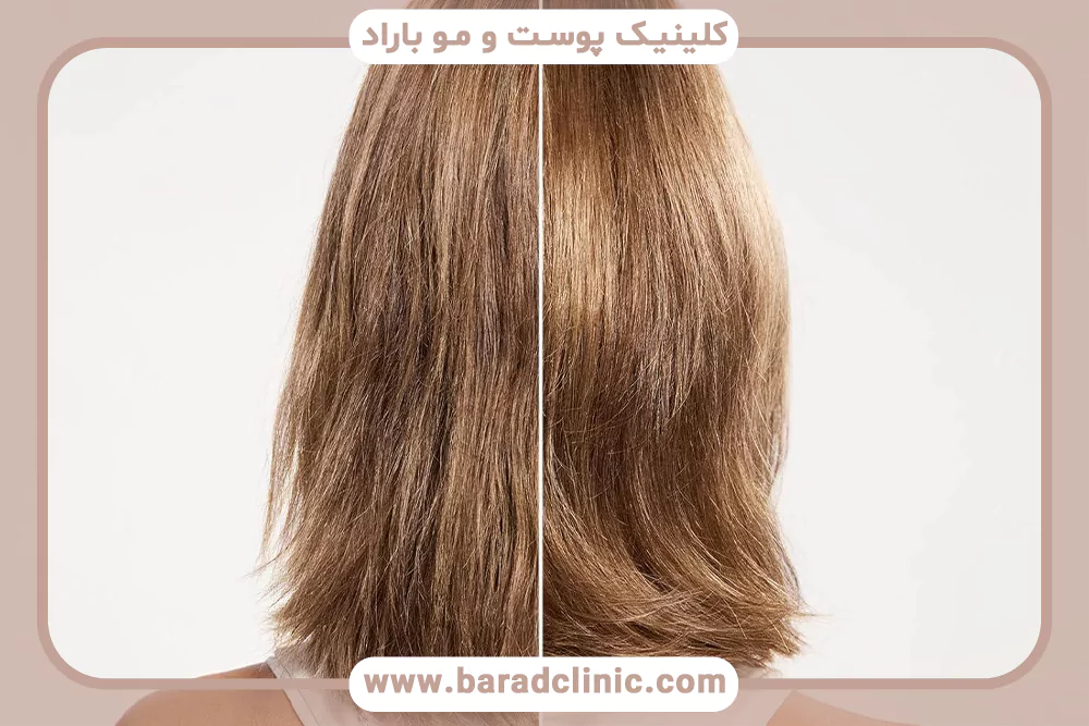 بازسازی کوتیکول مو