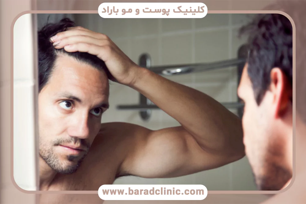 باورهای غلط درباره ریزش مو