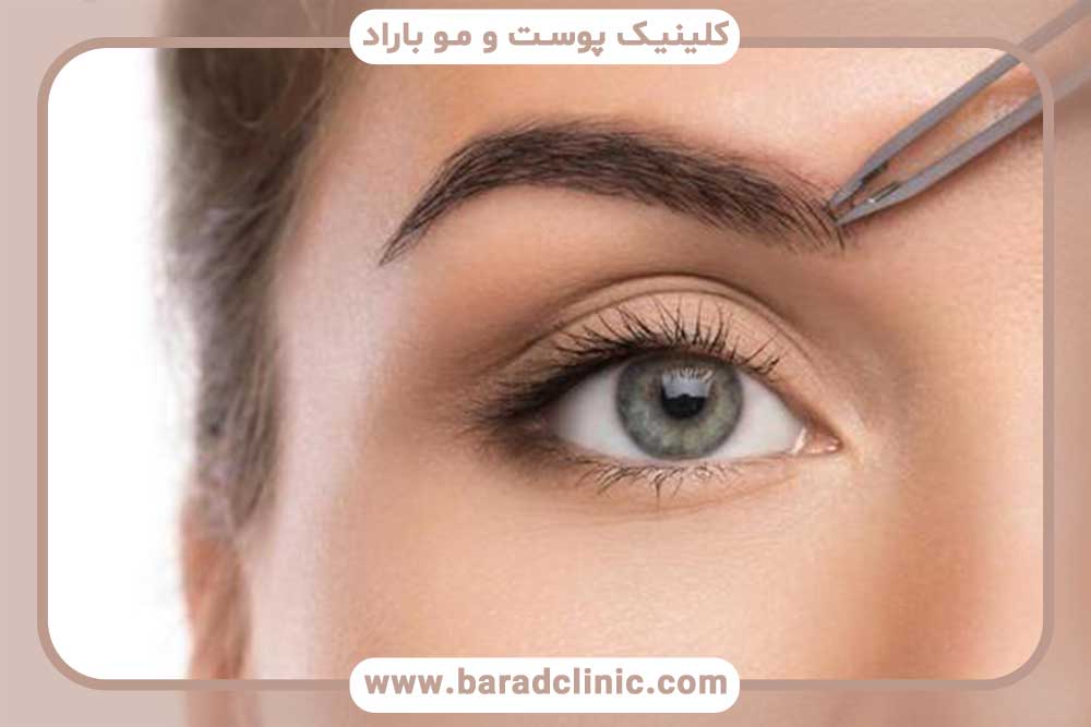 کاشت ابرو دائمی