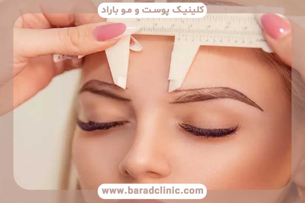 کاشت ابرو برای ابروهای کم‌پشت