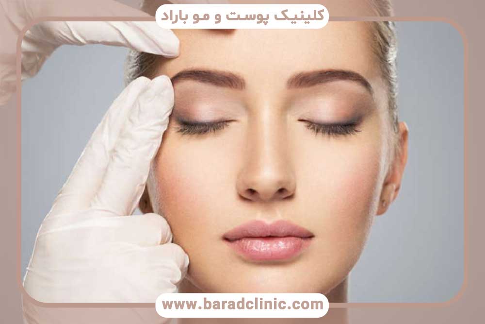کاشت ابرو برای ریزش ابرو