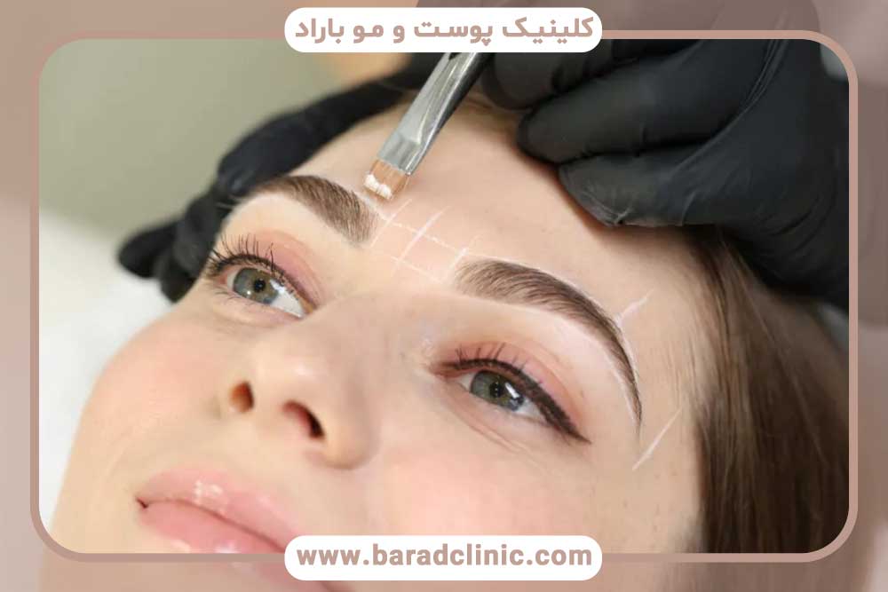 بهترین روش کاشت ابرو