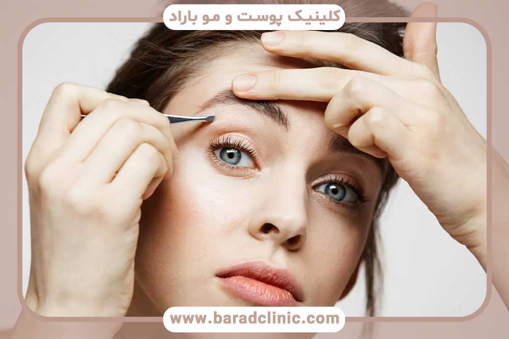 کاشت ابرو پلاس