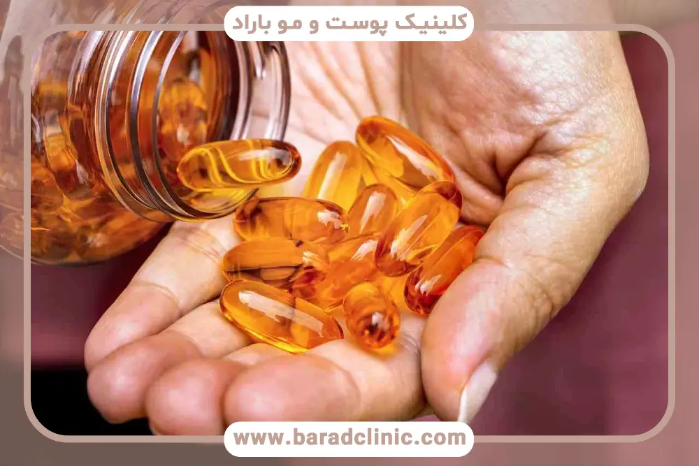 ویتامین بعد از کاشت مو