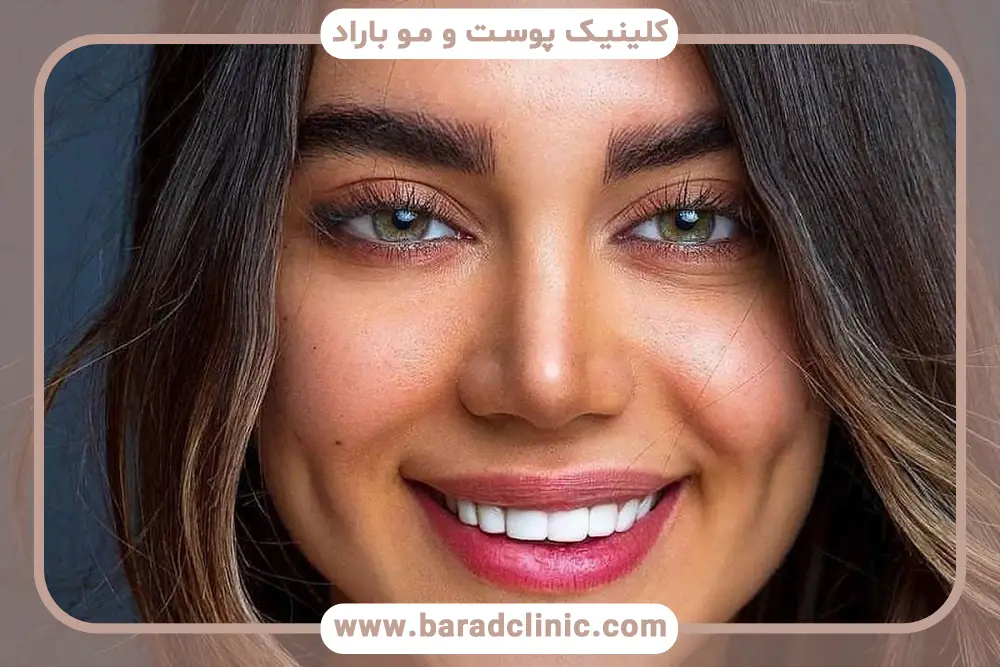ژل بوتاکس گونه