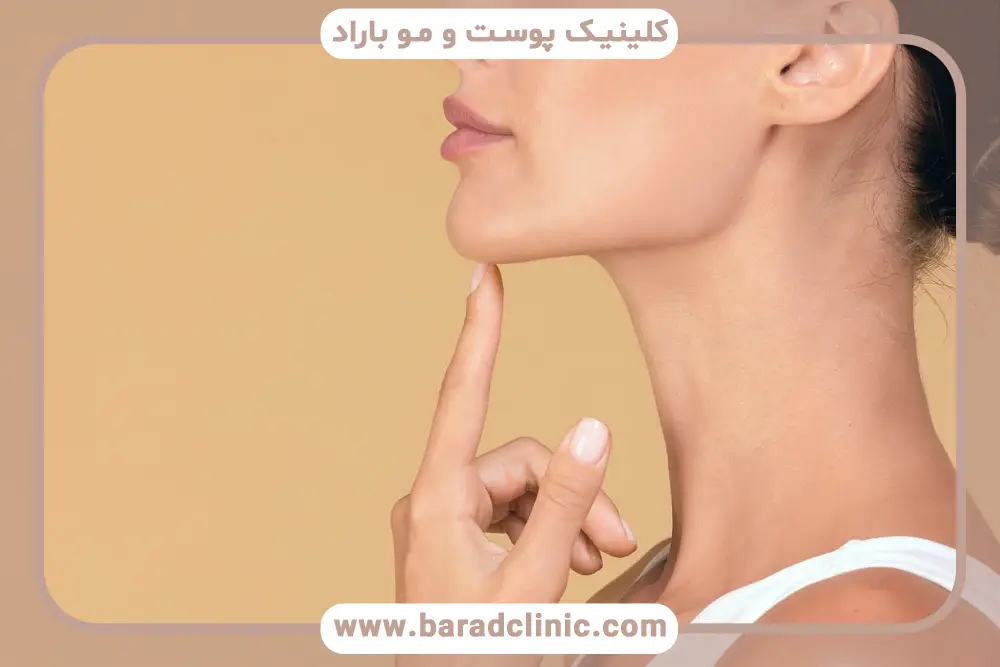 prp غبغب