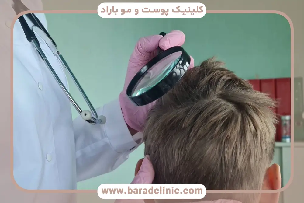 بهترین مکان برای کاشت مو