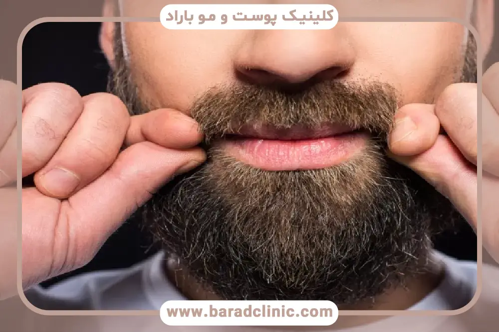 دکتر مزوتراپی ریش