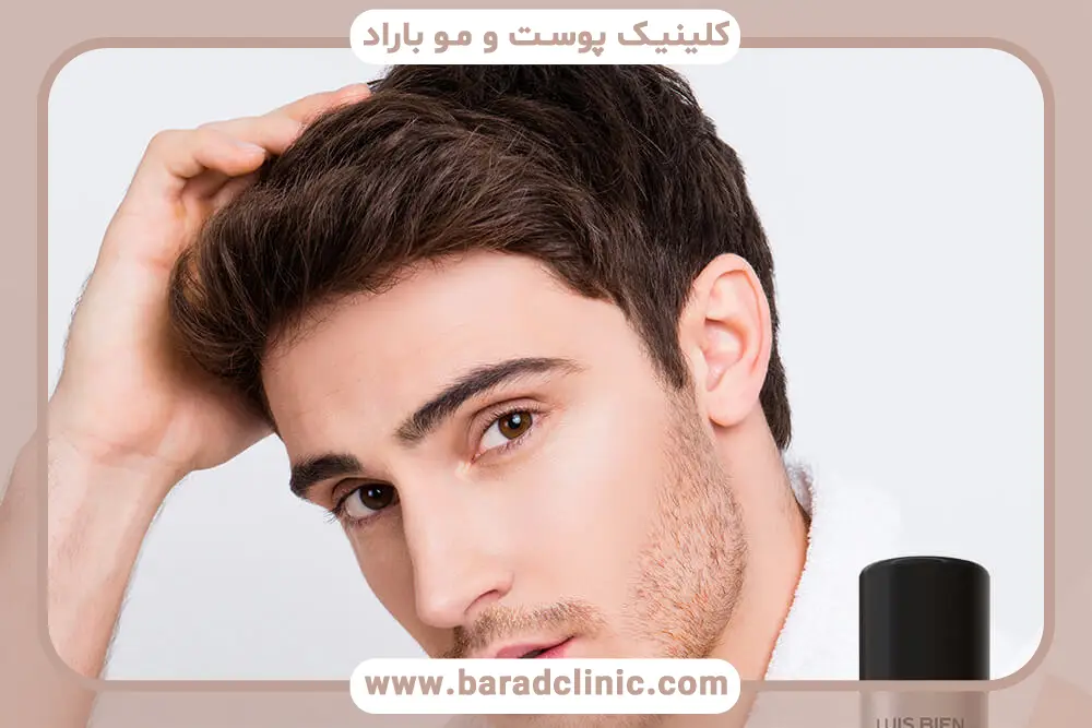 اسپری کاشت موقت مو  چیست؟