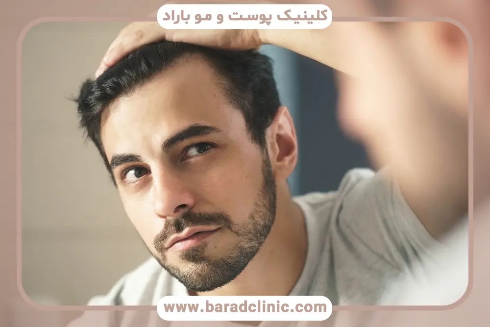 انتخاب اسپری کاشت موقت مو 