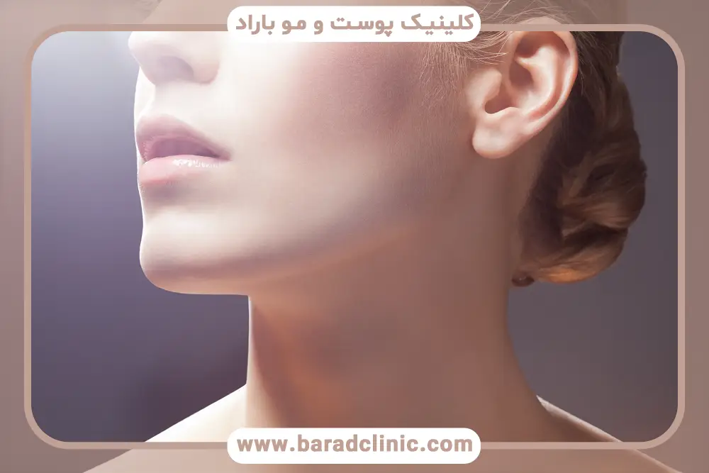 کاندیدای مناسب prp غبغب 