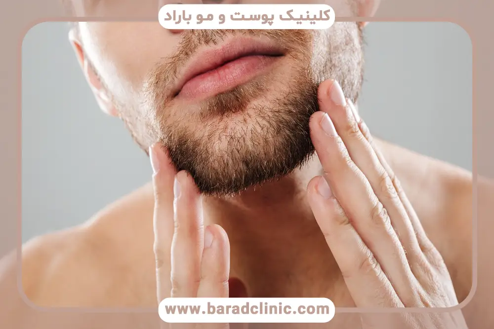 ویژگیهای دکتر مزوتراپی ریش