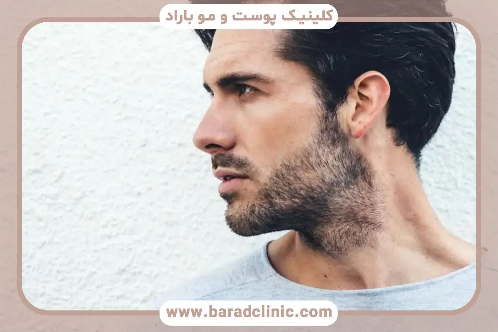 قبل و بعد مزوتراپی ریش، بررسی موارد منع